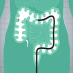 short colonoscopy